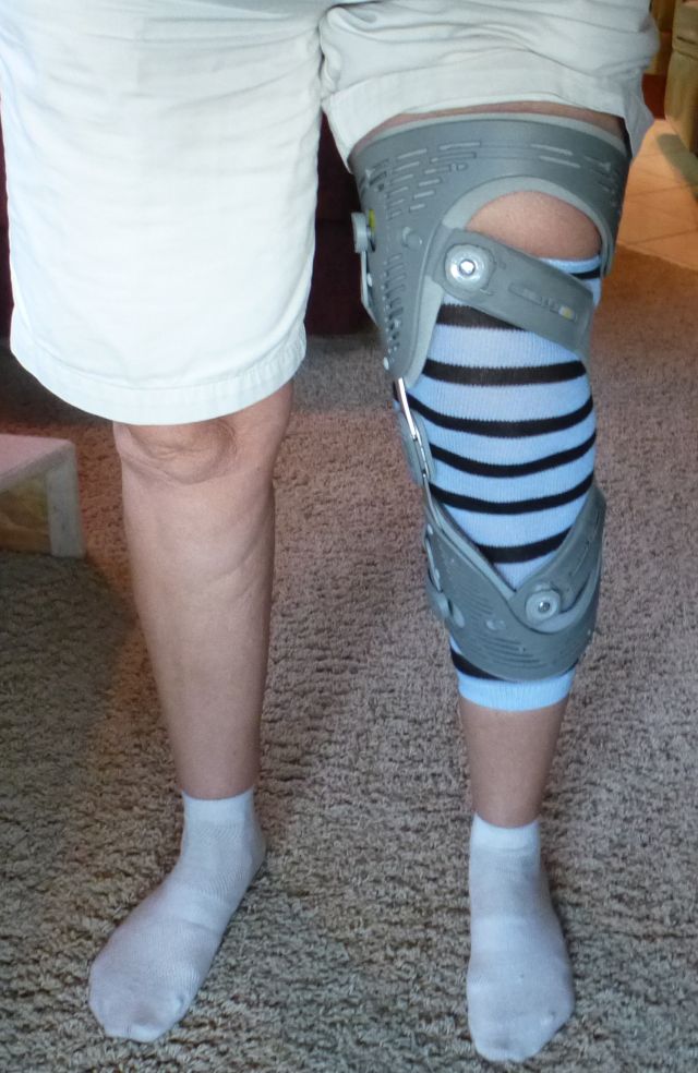 Unloader brace