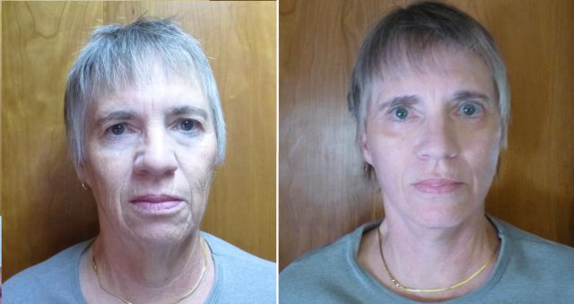 Gayle before and after