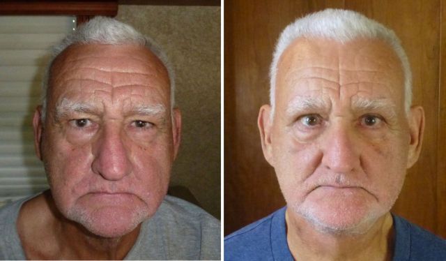 Jim before and after