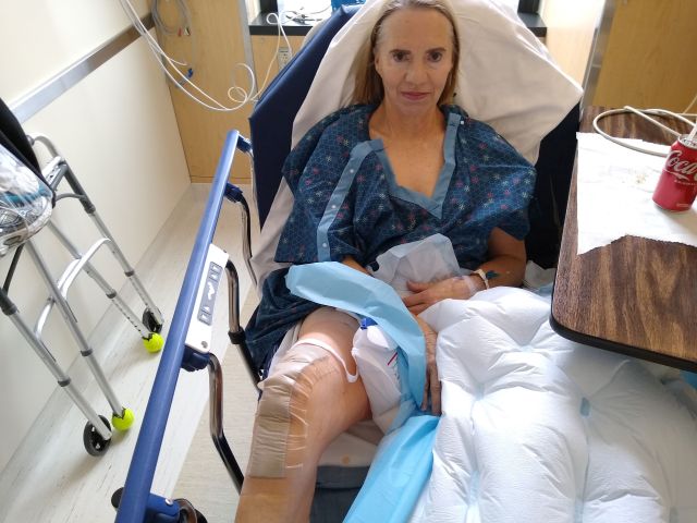 Knee replacement