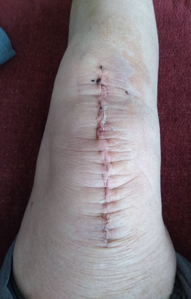 Knee