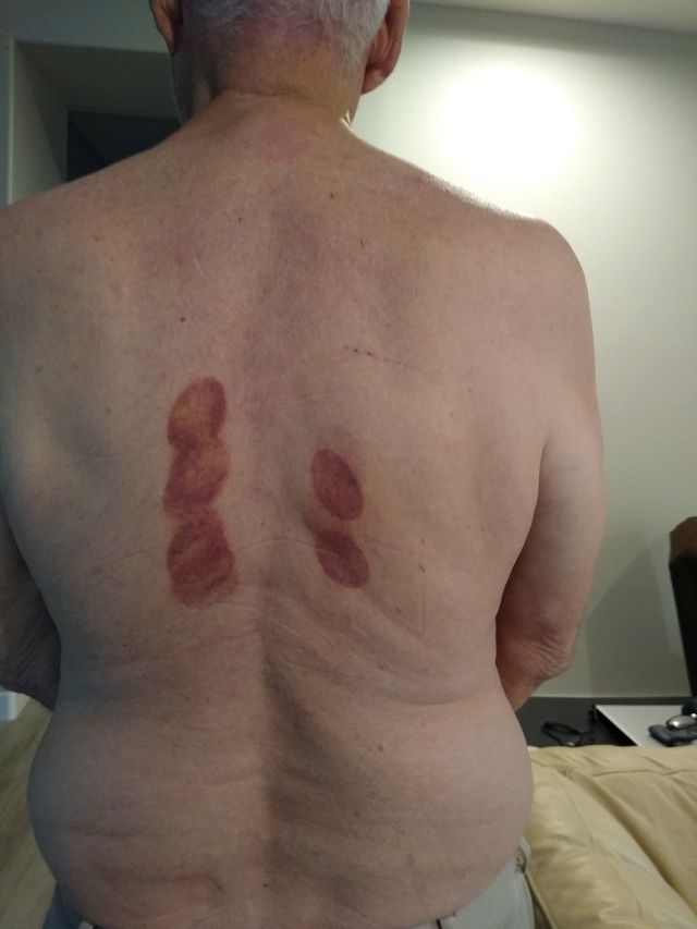 Jim back