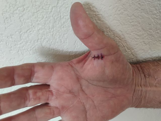 Jim thumb Jim thumb